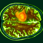 Colored CT scan of a section through a person