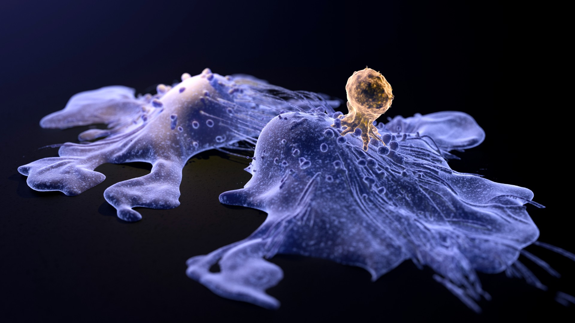 Медицинская иллюстрация двух раковых клеток фиолетового цвета на черном фоне.  Одна из раковых клеток (справа) подвергается атаке Т-клетки (золото).