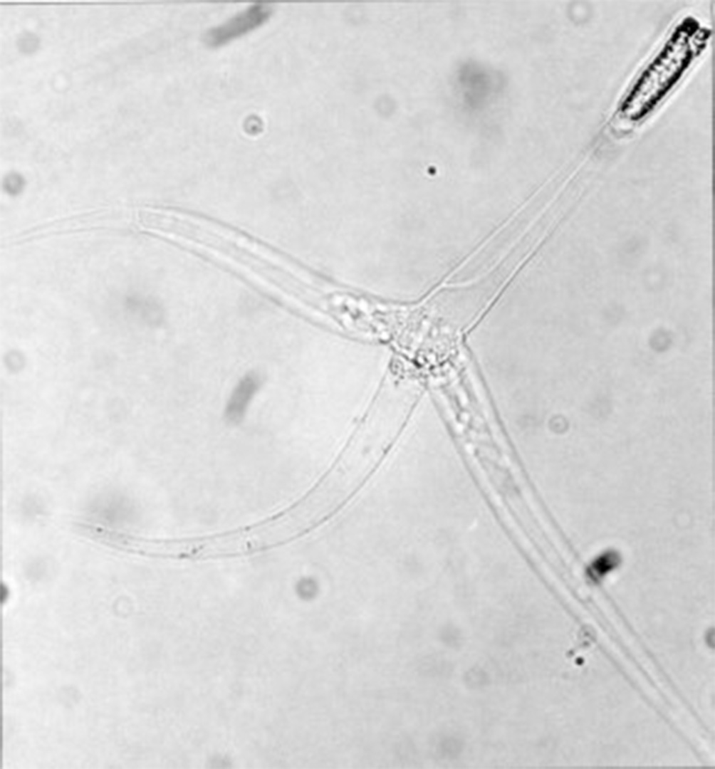 Увеличенное изображение миксозоя (Myxobolus cerebralis), паразита, обитающего в видах лосося и форели.