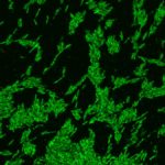 microscopic image of bacterial cells full of bright green cholestorol molecules