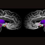 Two side-by-side MRI scans of the two halves of a human brain shows structures deep in the middle of the brain highlighted in different colors