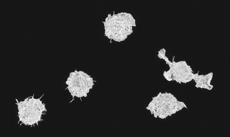 Исследование раскрывает скрытое разнообразие клеток врожденного иммунитета