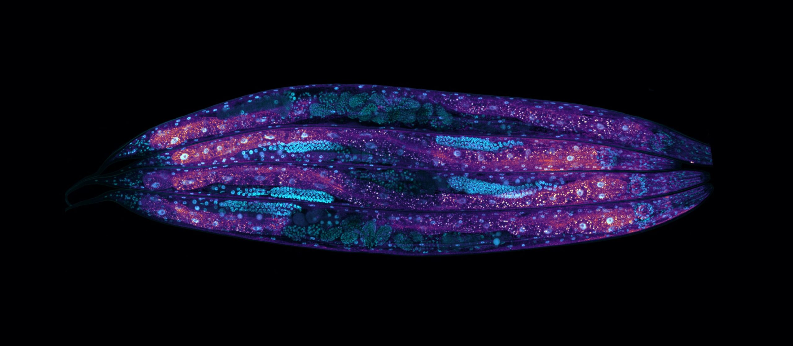 Исследование C. elegans показало, что баланс мРНК в клетках влияет на продолжительность жизни