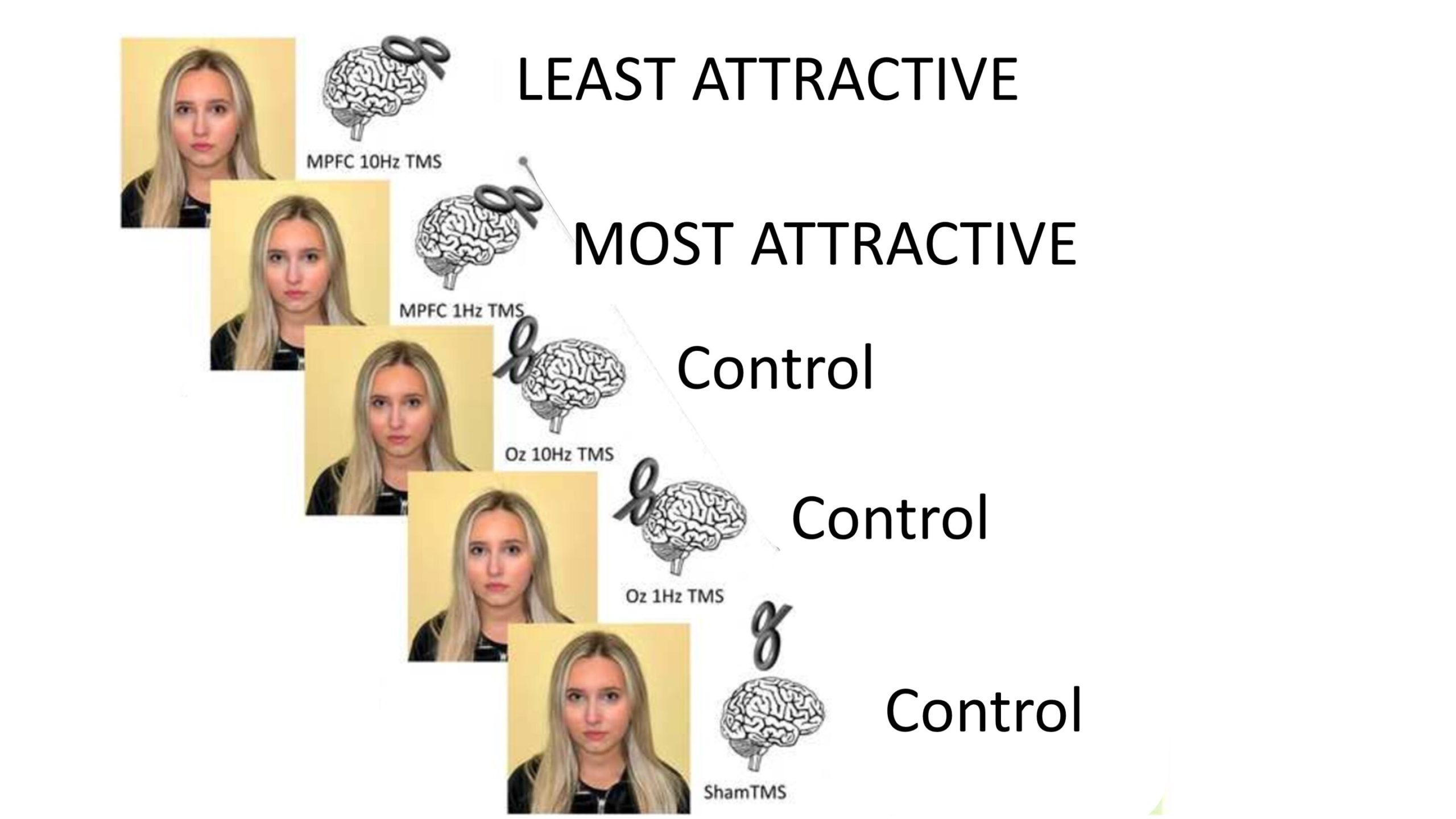 Исследование предполагает, что стимуляция медиальной префронтальной коры меняет восприятие привлекательности человека