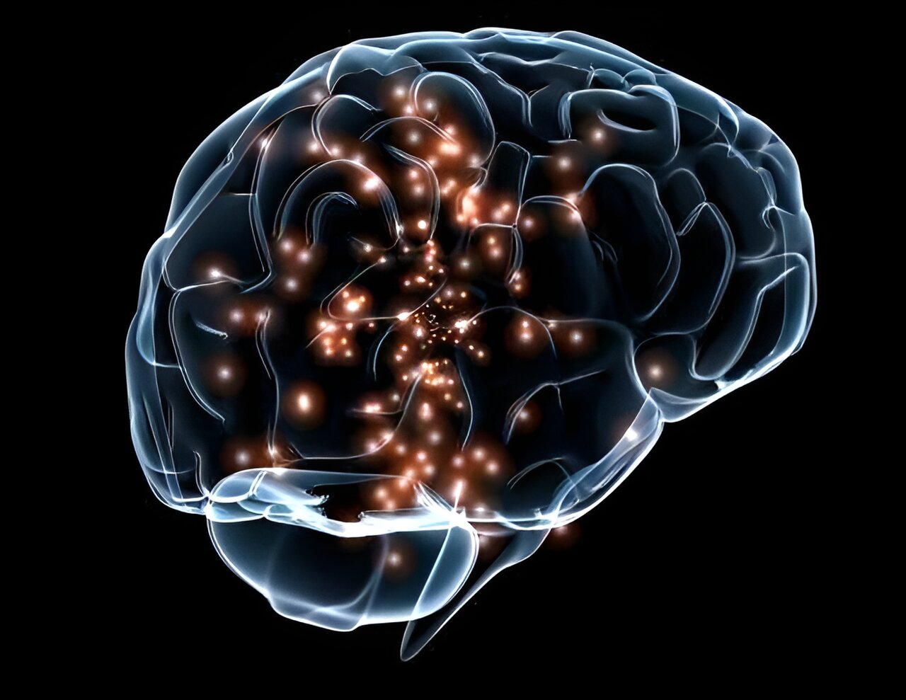Ученые, возможно, открыли способ диагностировать неуловимое нейрорасстройство